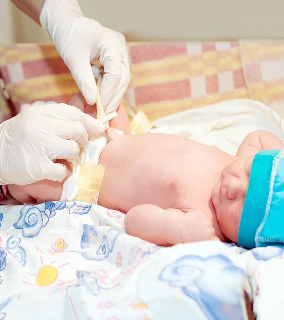 4 Simple Ways To Take Care Of Your New Born Baby Belly Button