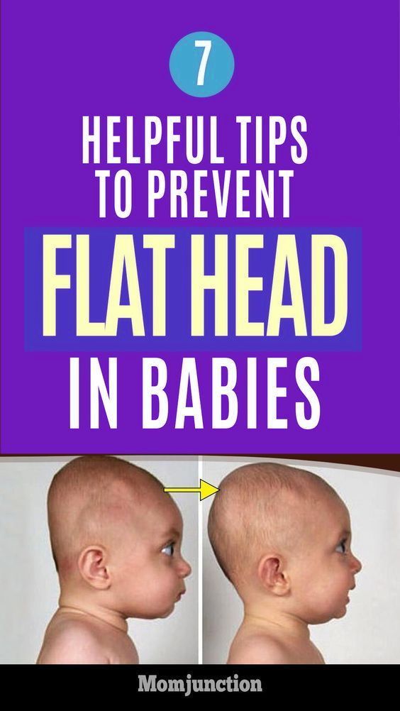 7 Helpful Tips To Prevent Flat Head In Babies