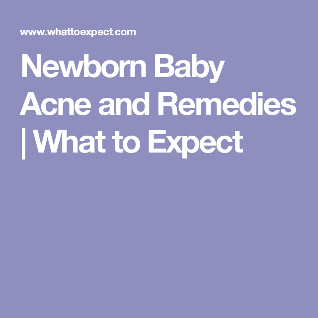 Baby Acne Remedies