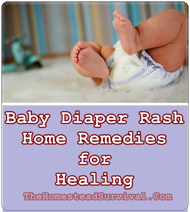 Baby Diaper Rash Home Remedies for Healing