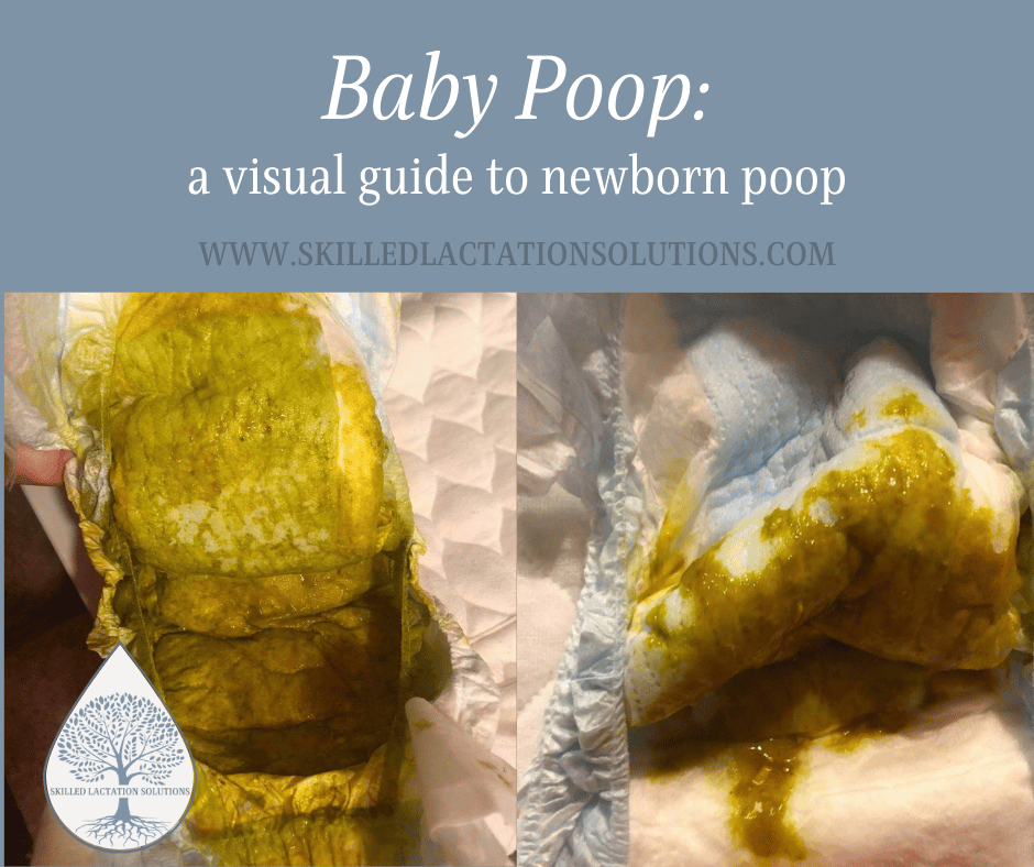 Baby Poop: A Visual Guide to Newborn Poop