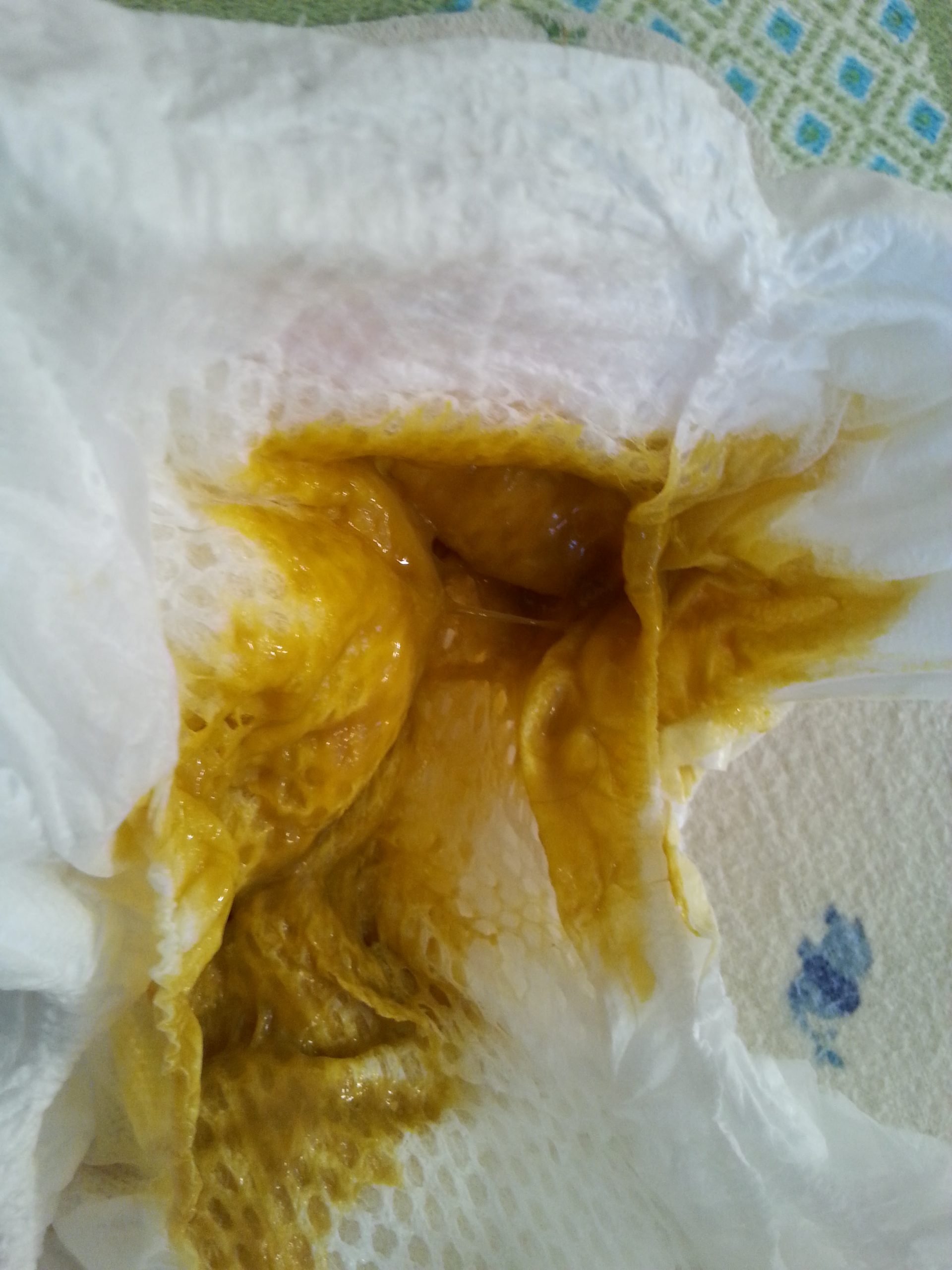 Clear Yellow Mucus Diarrhea