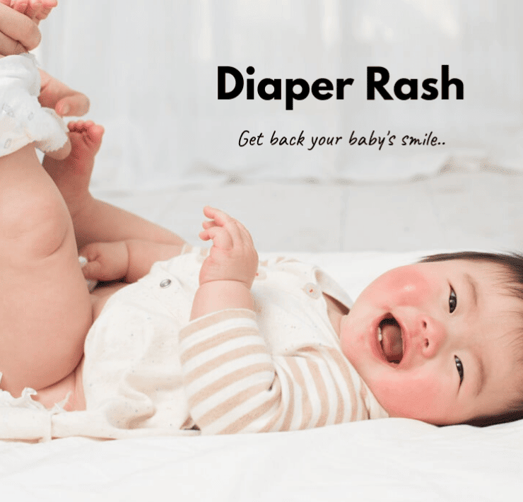 Cornstarch For Diaper Rash: Does It Work?