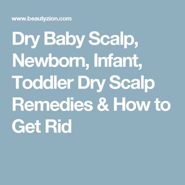 Dry Baby Scalp, Newborn, Infant, Toddler Dry Scalp Remedies &  How to ...