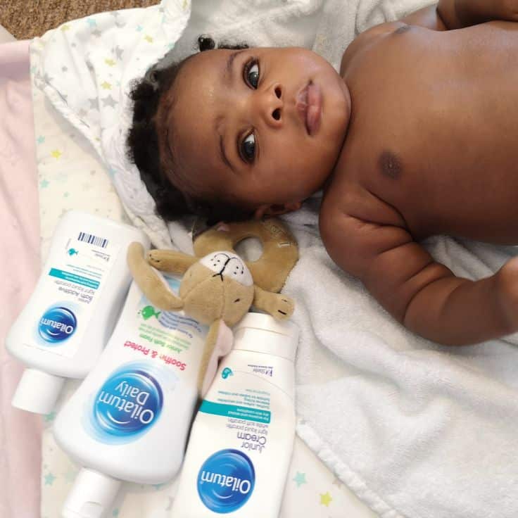 Dry skin in Babies/kids: My experience and solution  Everything ...