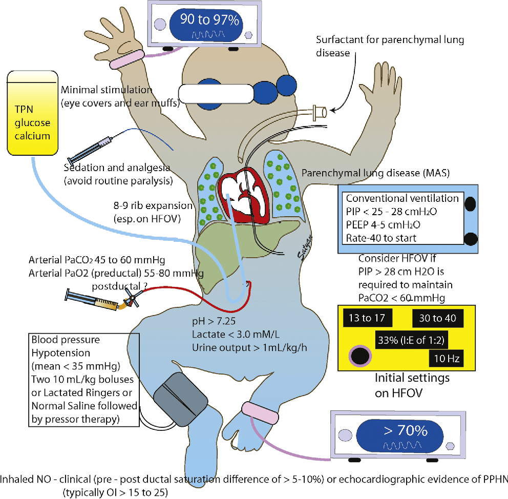 Figure 7 from Update on PPHN: mechanisms and treatment.