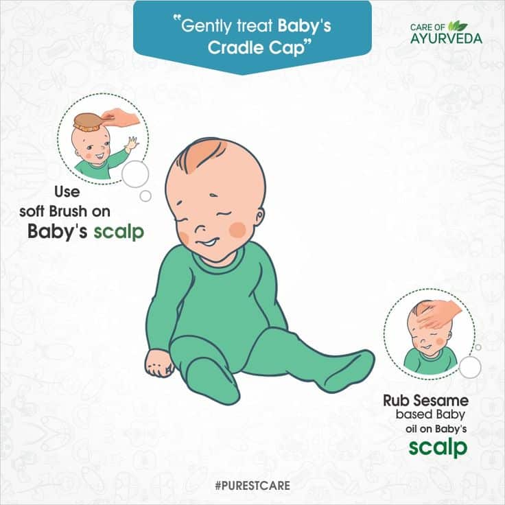 Gently treat babys cradle cap by massaging babys scalp with softly by ...