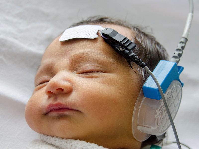 Hearing Loss in Newborns: The