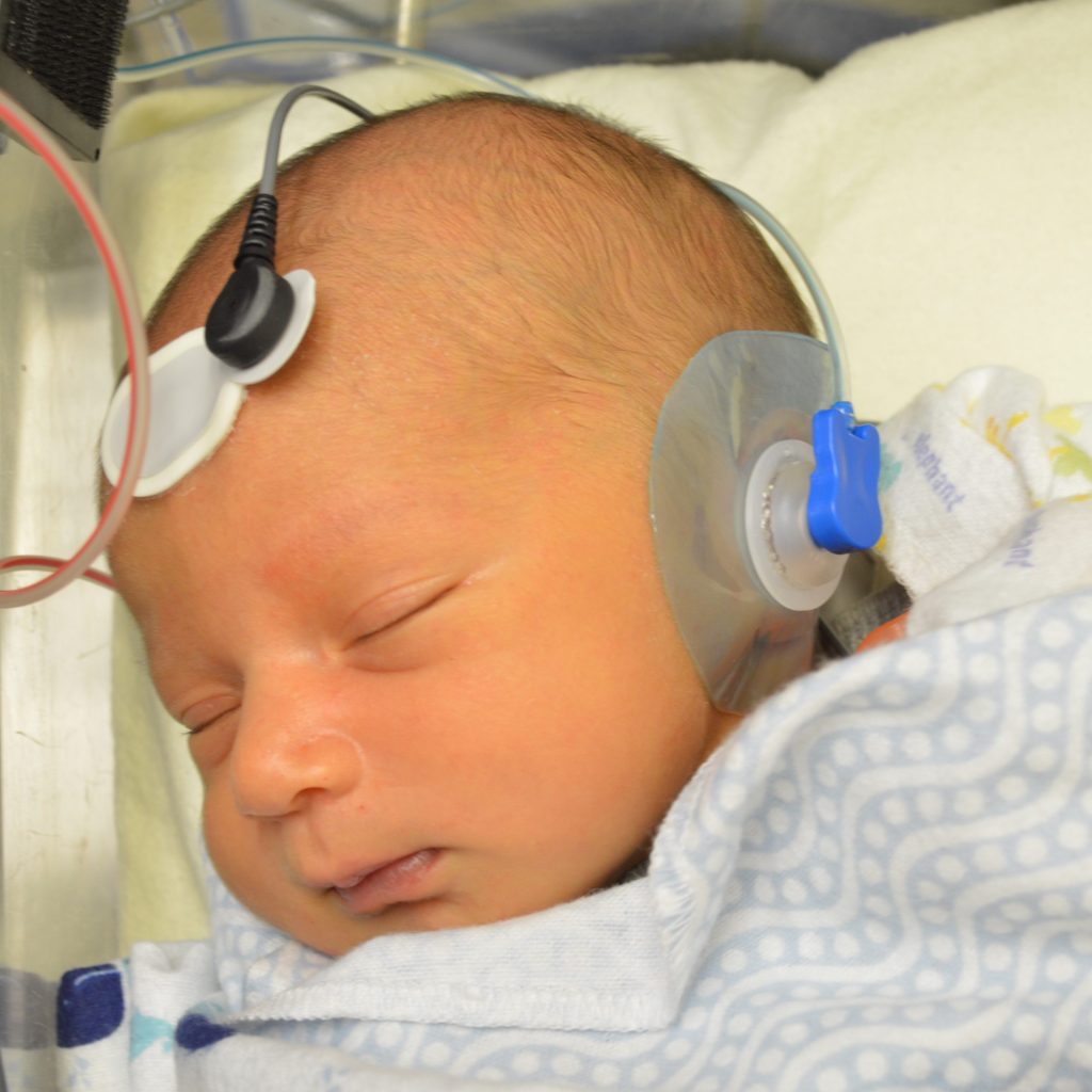 Hearing test may detect autism in newborns
