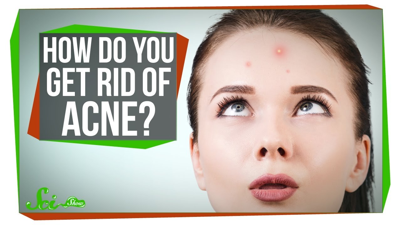» How Do You Get Rid of Acne?