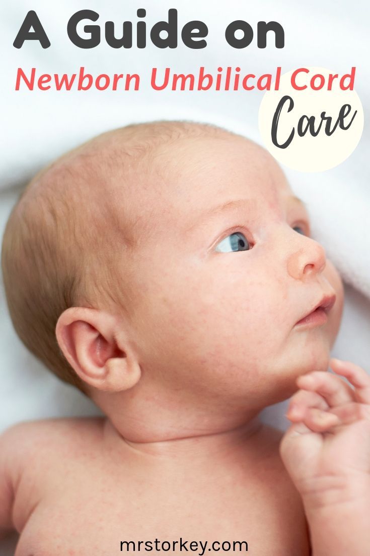 How to care for newborn umbilical cord? Read our new post ...