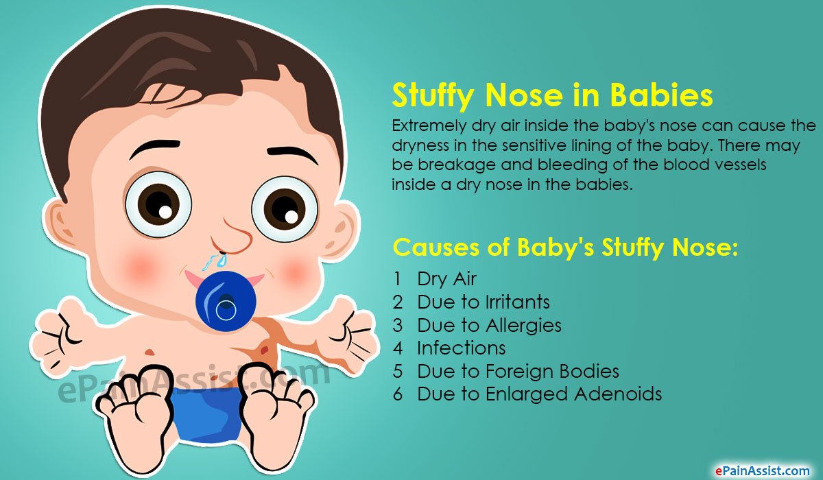How to Get Rid of Babys Stuffy Nose?