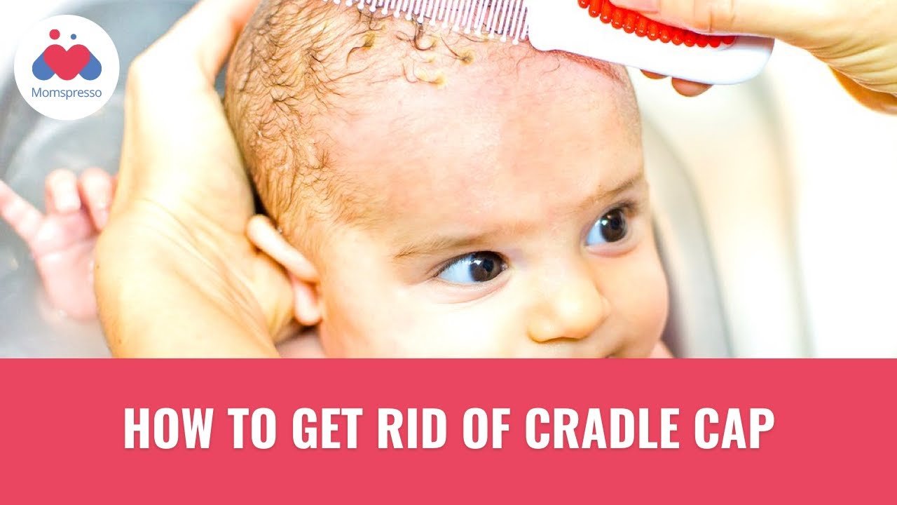 How To Get Rid Of Cradle Cap