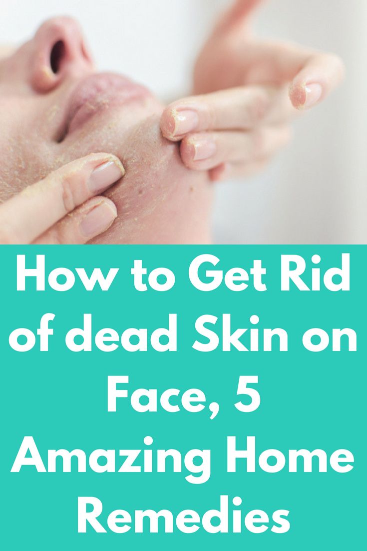 How to Get Rid of dead Skin on Face, 5 Amazing Home ...
