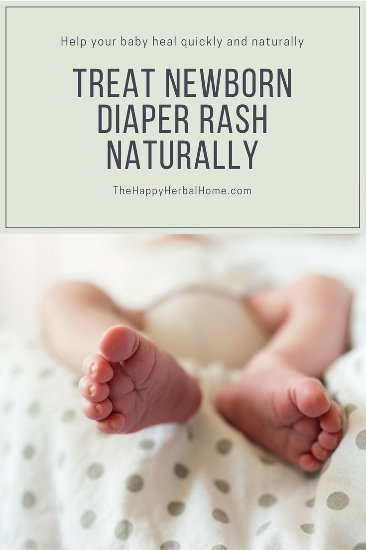 How to heal a bad diaper rash, quickly and naturally. # ...