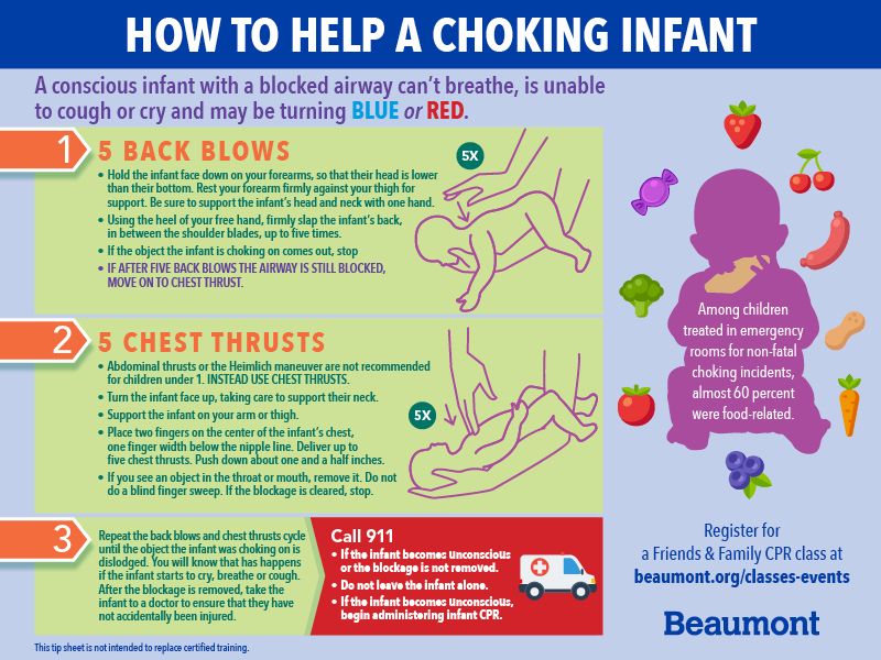 How to help a choking infant
