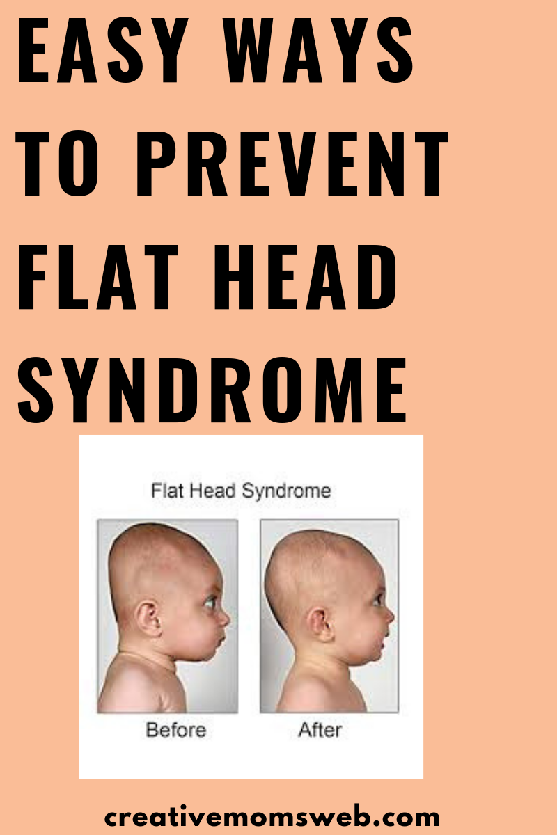 How to Prevent baby flat head syndrome