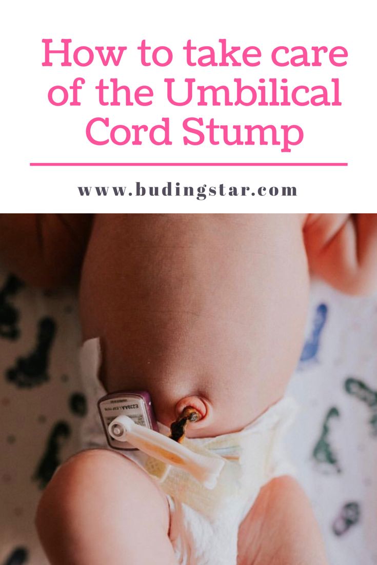 How to take care of the Umbilical Cord Stump