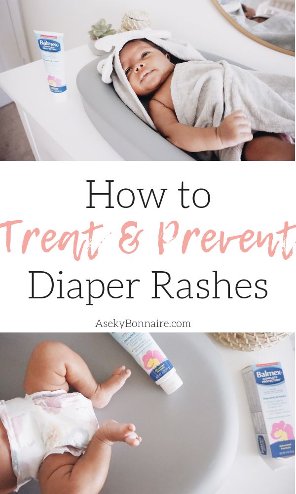 How to Treat and Prevent diaper rashes