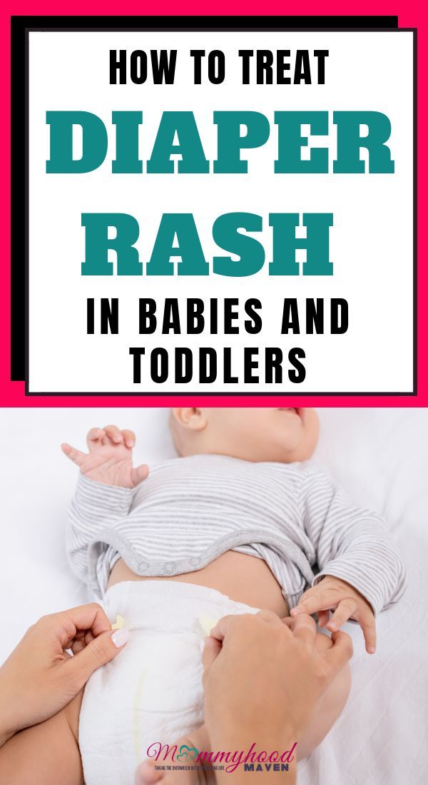HOW TO TREAT DIAPER RASH IN A NEWBORN BABY