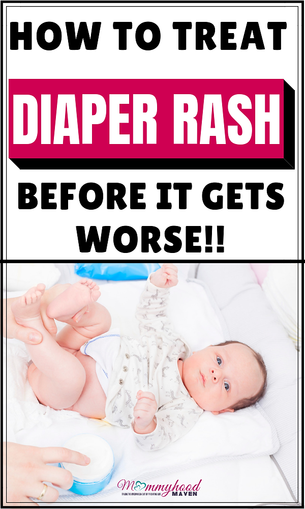 HOW TO TREAT DIAPER RASH IN A NEWBORN BABY