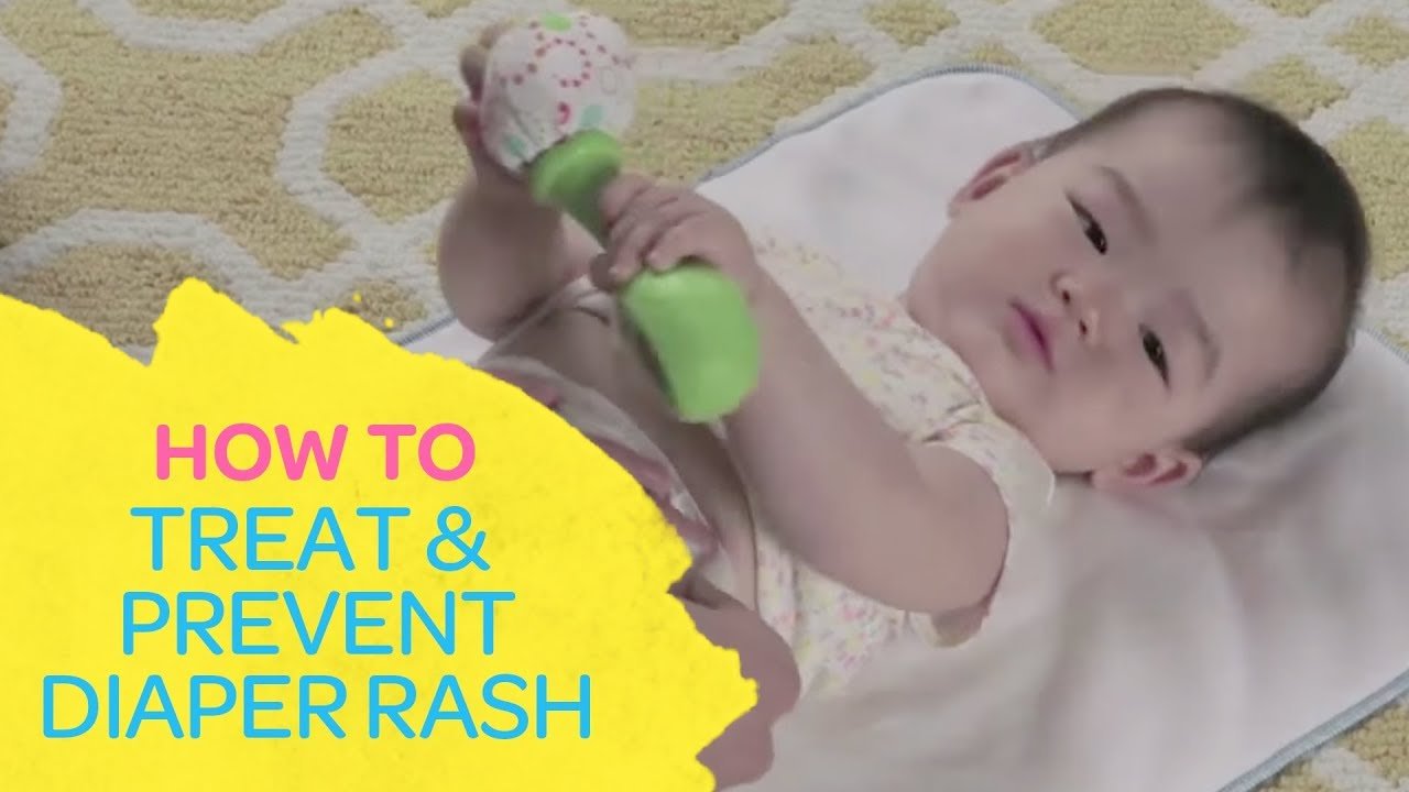 How To Treat &  Prevent Diaper Rash