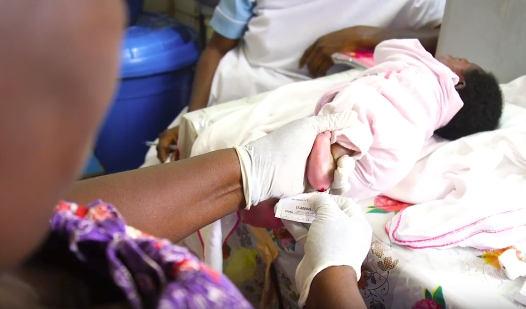 Improving newborn sickle cell screening in Africa: We can ...