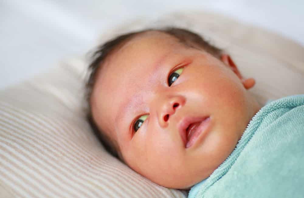 Infant Jaundice: More Harmful Than You May Think