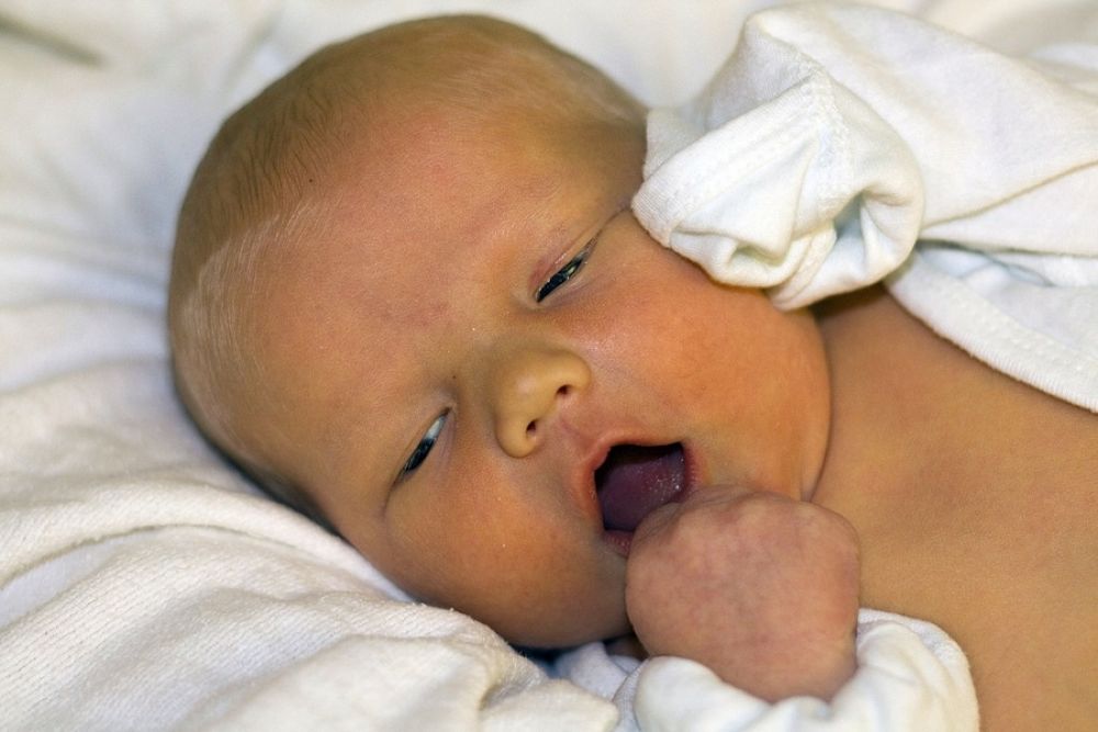 Jaundice In Babies