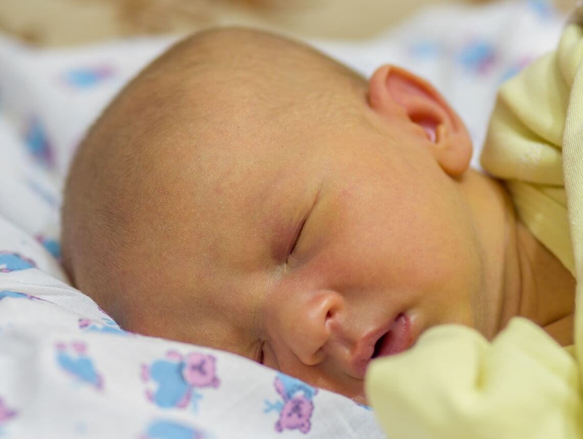Jaundice In Newborn Baby Cause
