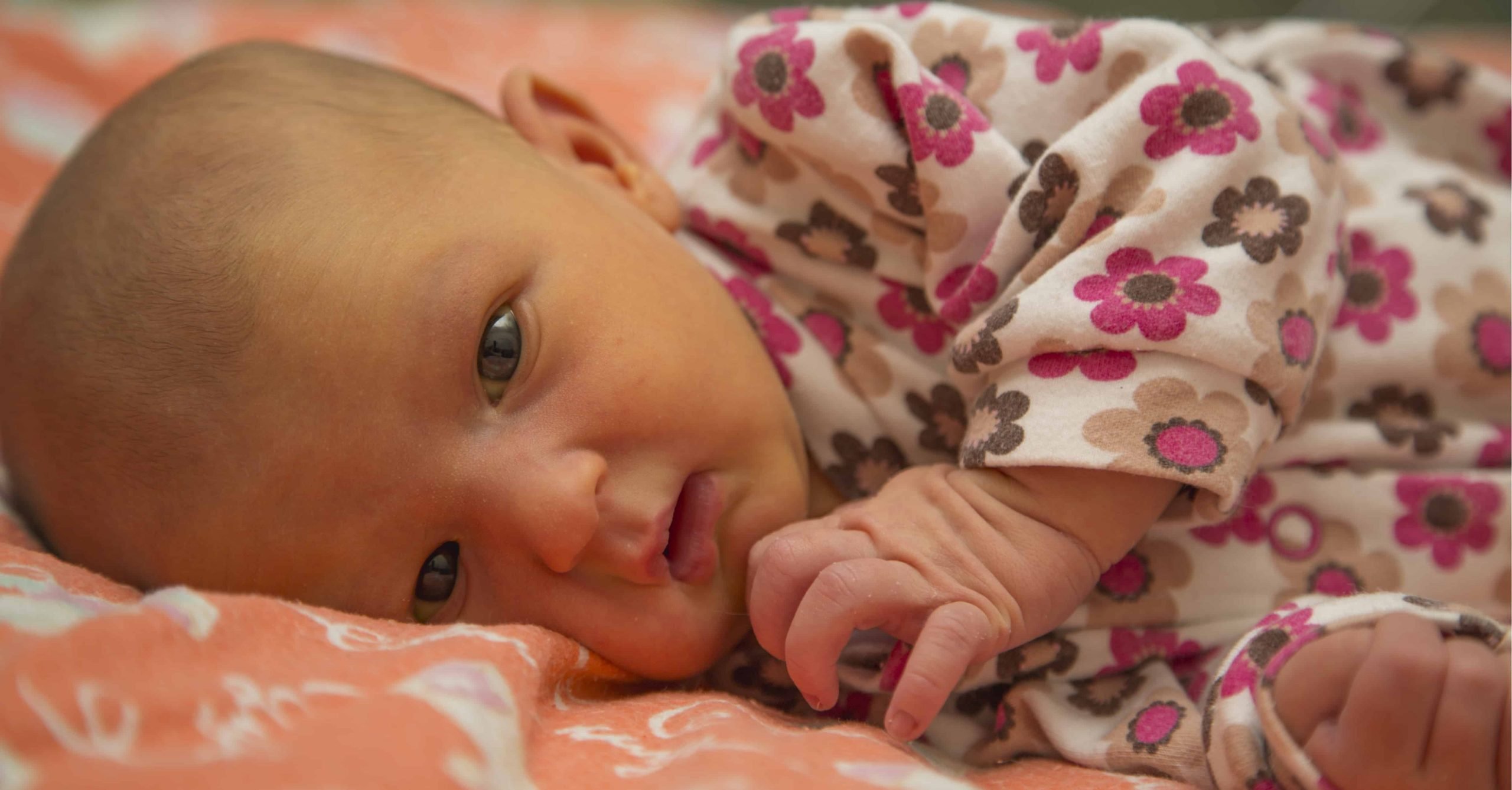 Jaundice In Newborns