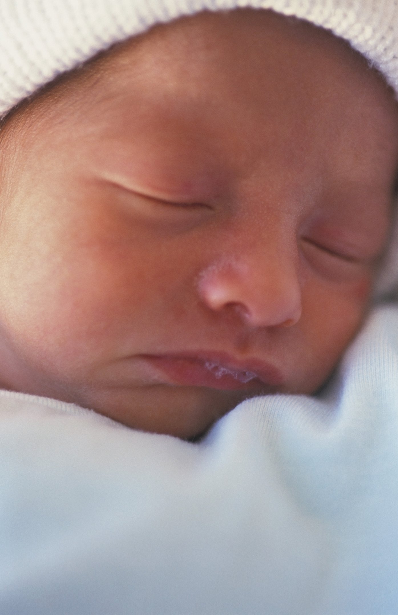 Jaundice Levels in a Newborn