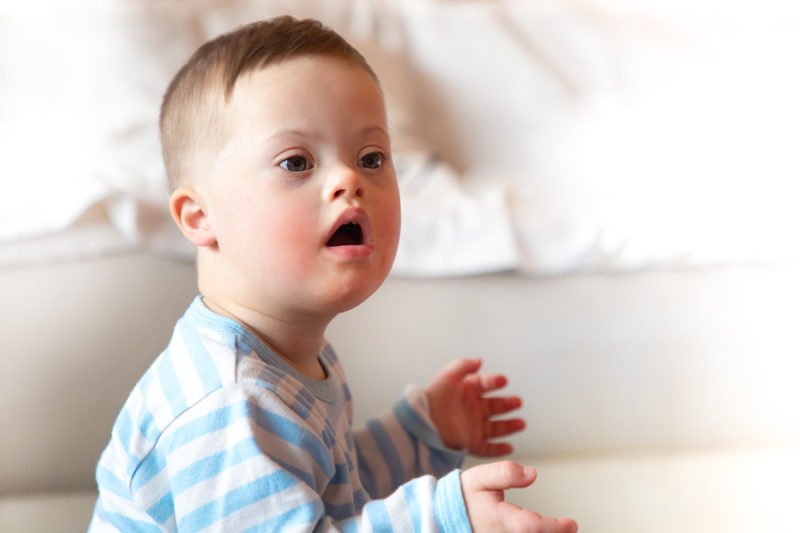 Know the Signs of a Dual Diagnosis of Down Syndrome and Autism Spectrum ...