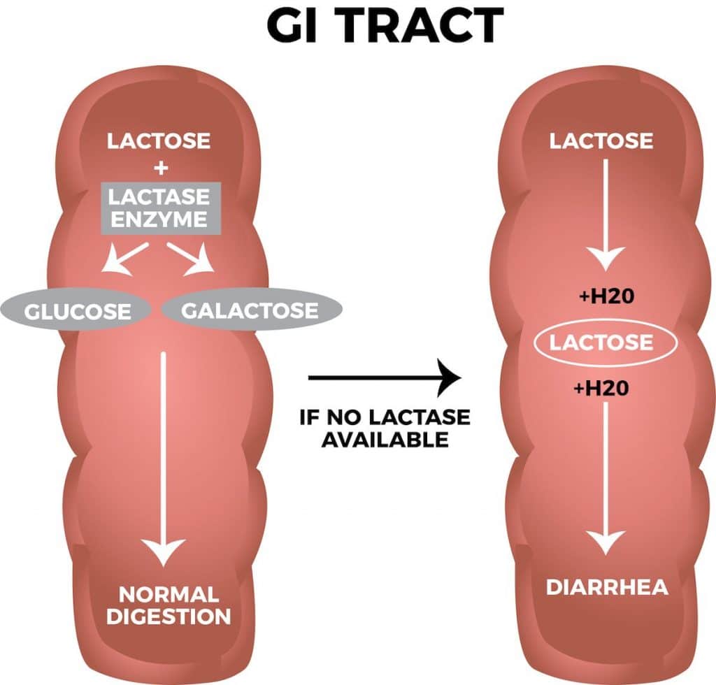 Lactose Intolerance Explained