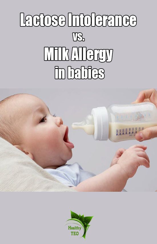 Lactose Intolerance vs. Milk Allergy In Babies