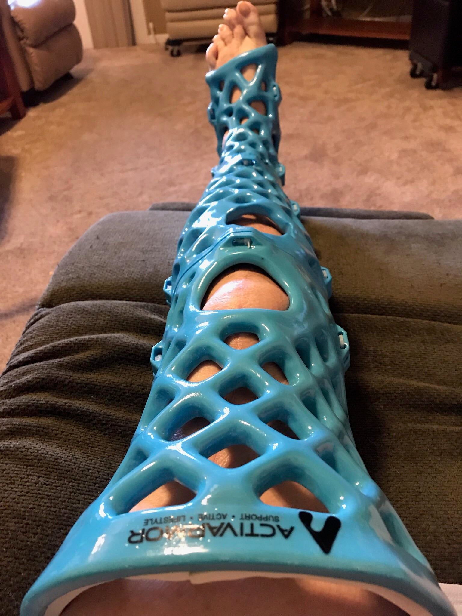 My moms 3D printed cast. She can take a shower with it! : pics