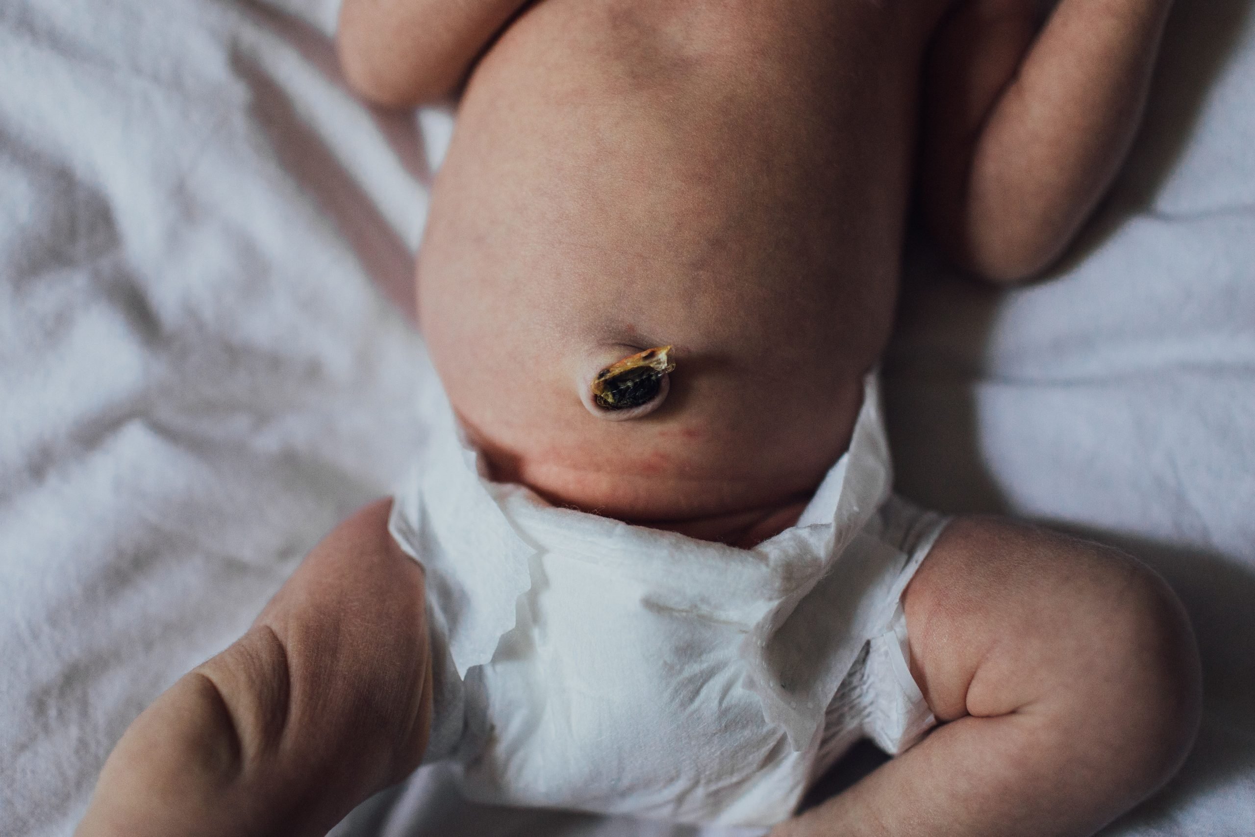 Newborn Baby Belly Button