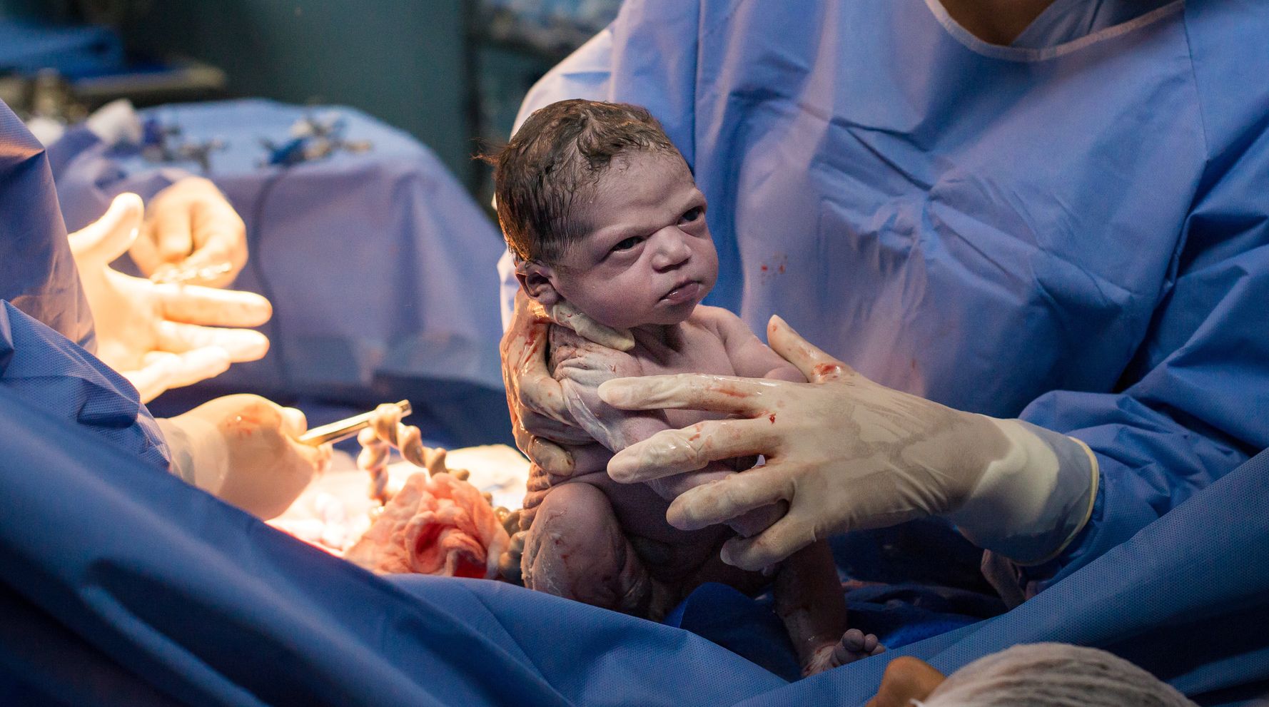 Newborn Baby Makes Epic Face In Birth Photo