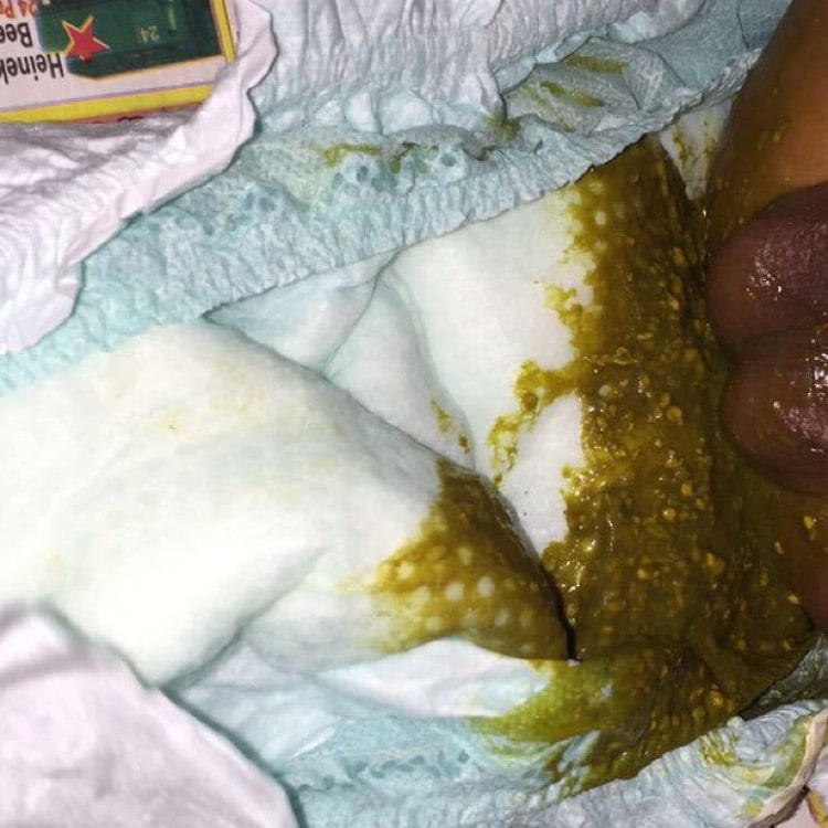 Newborn Baby Poop Green Seedy