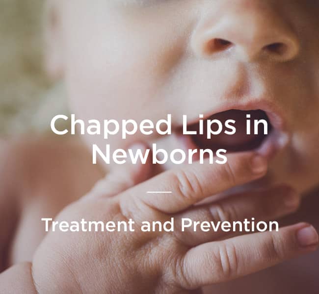 Newborn Chapped Lips: How to Prevent and Treat
