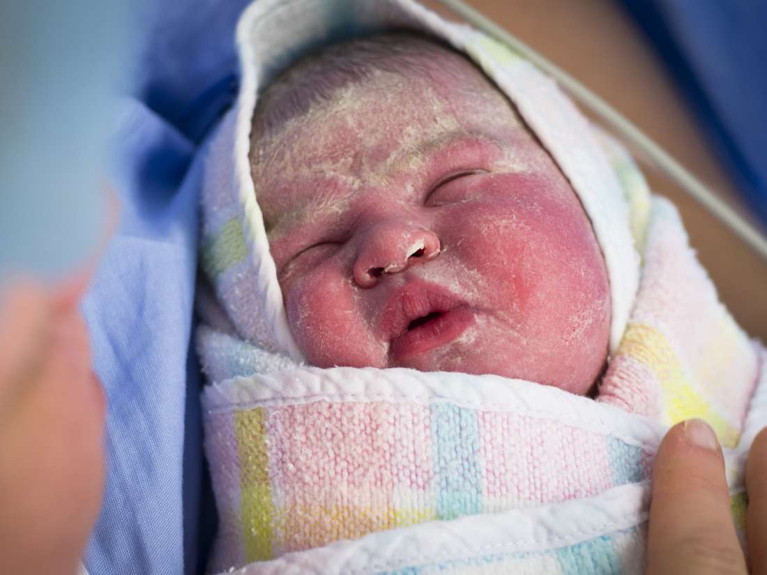 Newborn skin peeling: Causes, treatment, and home remedies