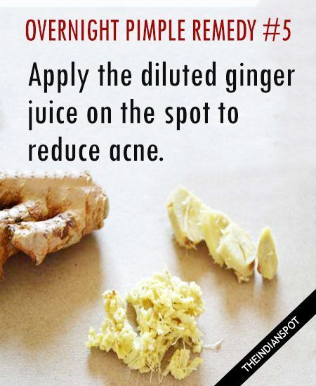 Overnight pimple remedy with Ice cubes: Rub an ice cube over the pimple ...