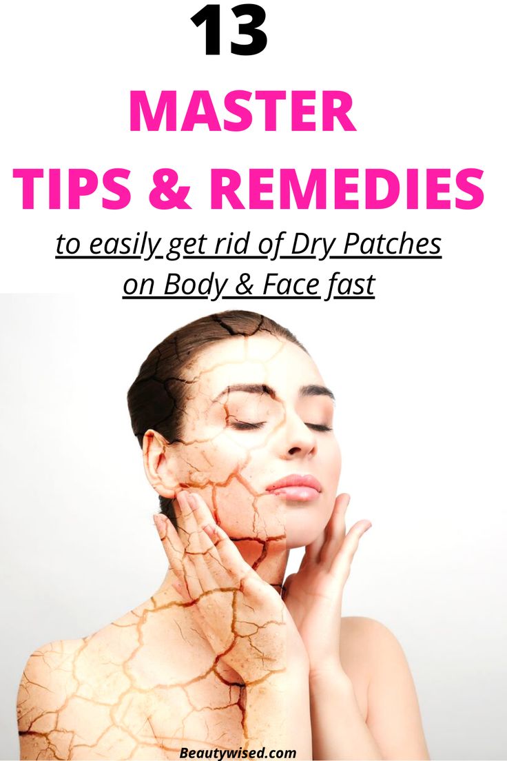Pin on Dry skin care on face
