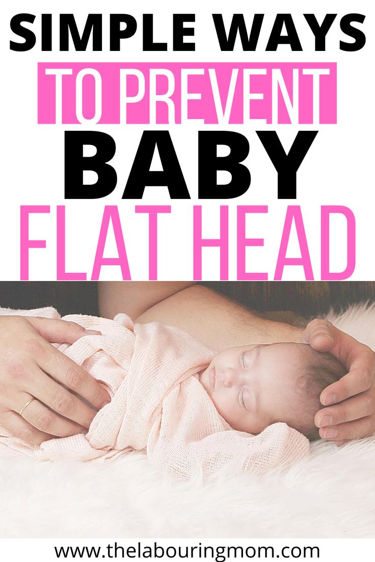 Prevent Flat Head Syndrome in your Newborn Baby in 2020