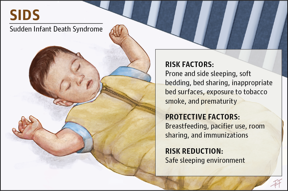 Reducing the Risk of Sudden Infant Death Syndrome ...
