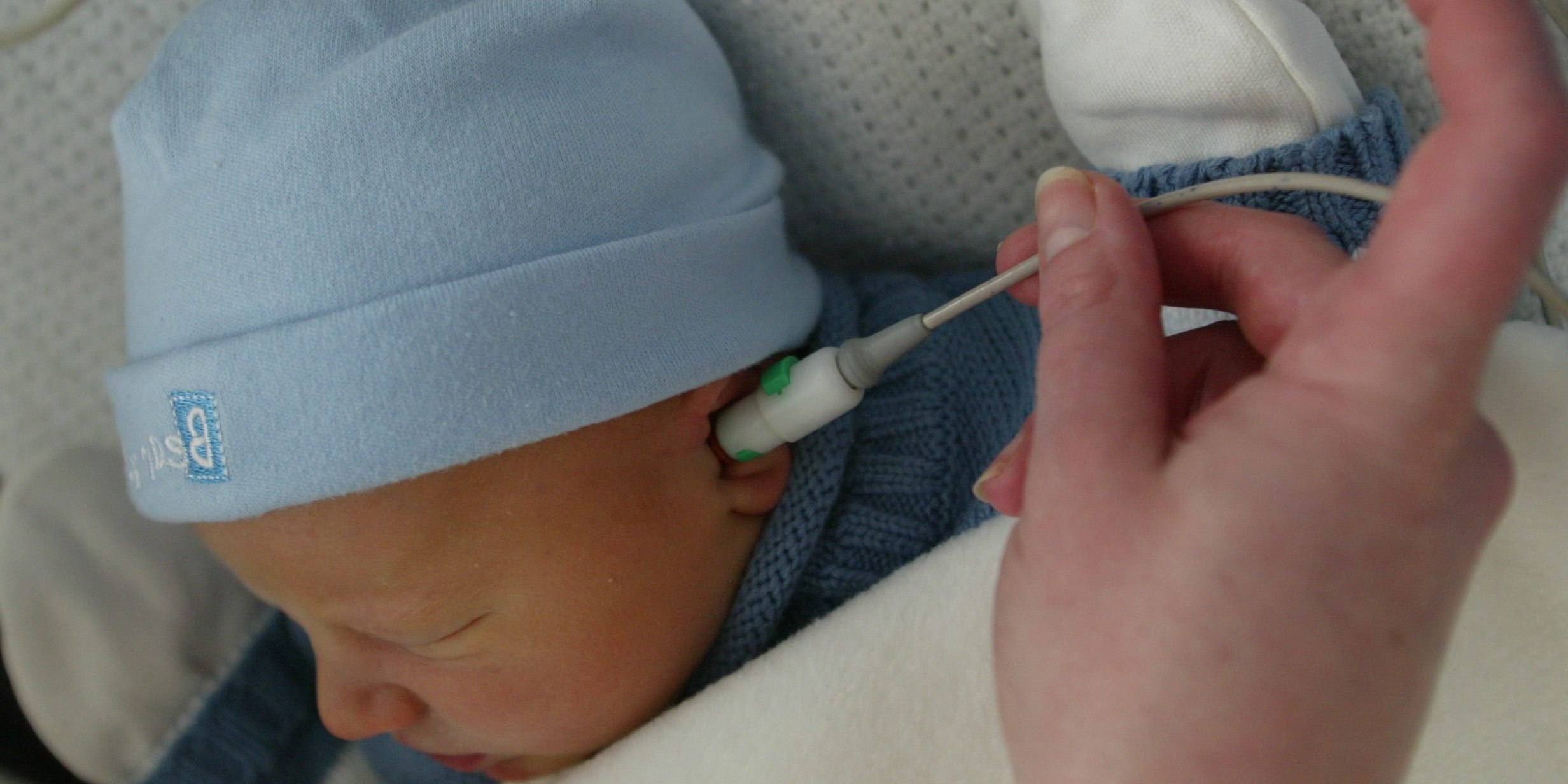 Sharing best practice in newborn hearing screening to ensure early ...