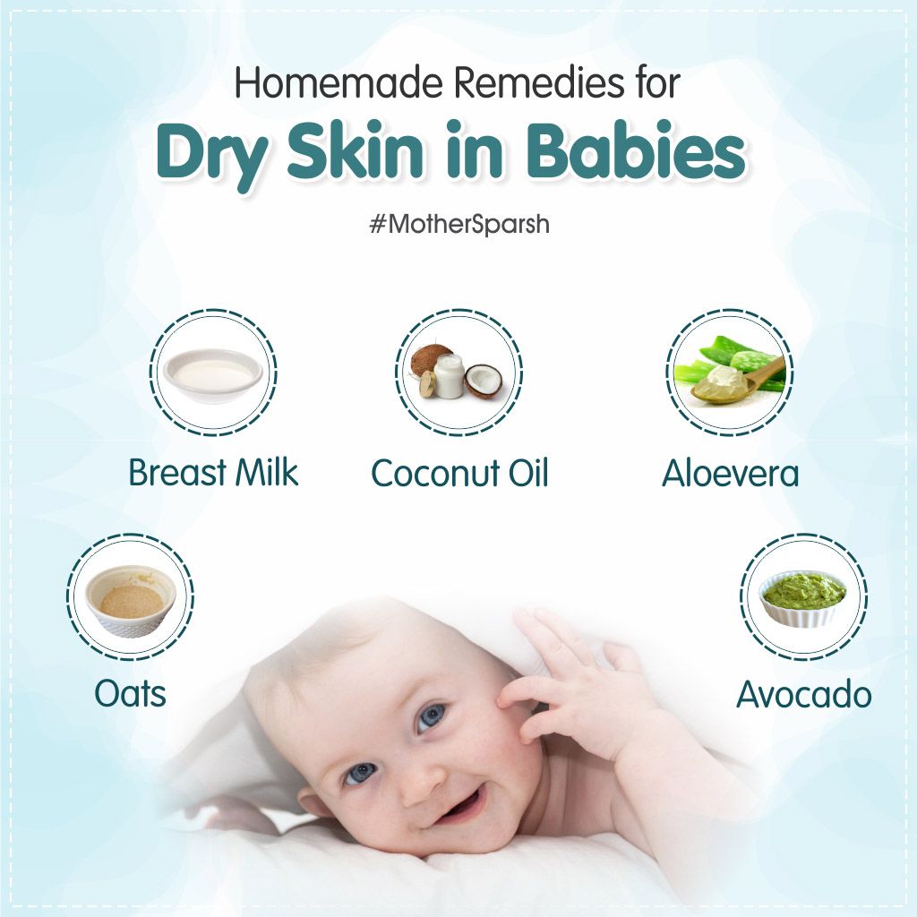 Some Babies have dry skin problems. here are some of the Home #Remedies ...