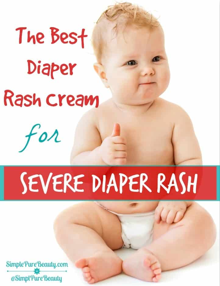 The Best Diaper Rash Cream for Severe Diaper Rash
