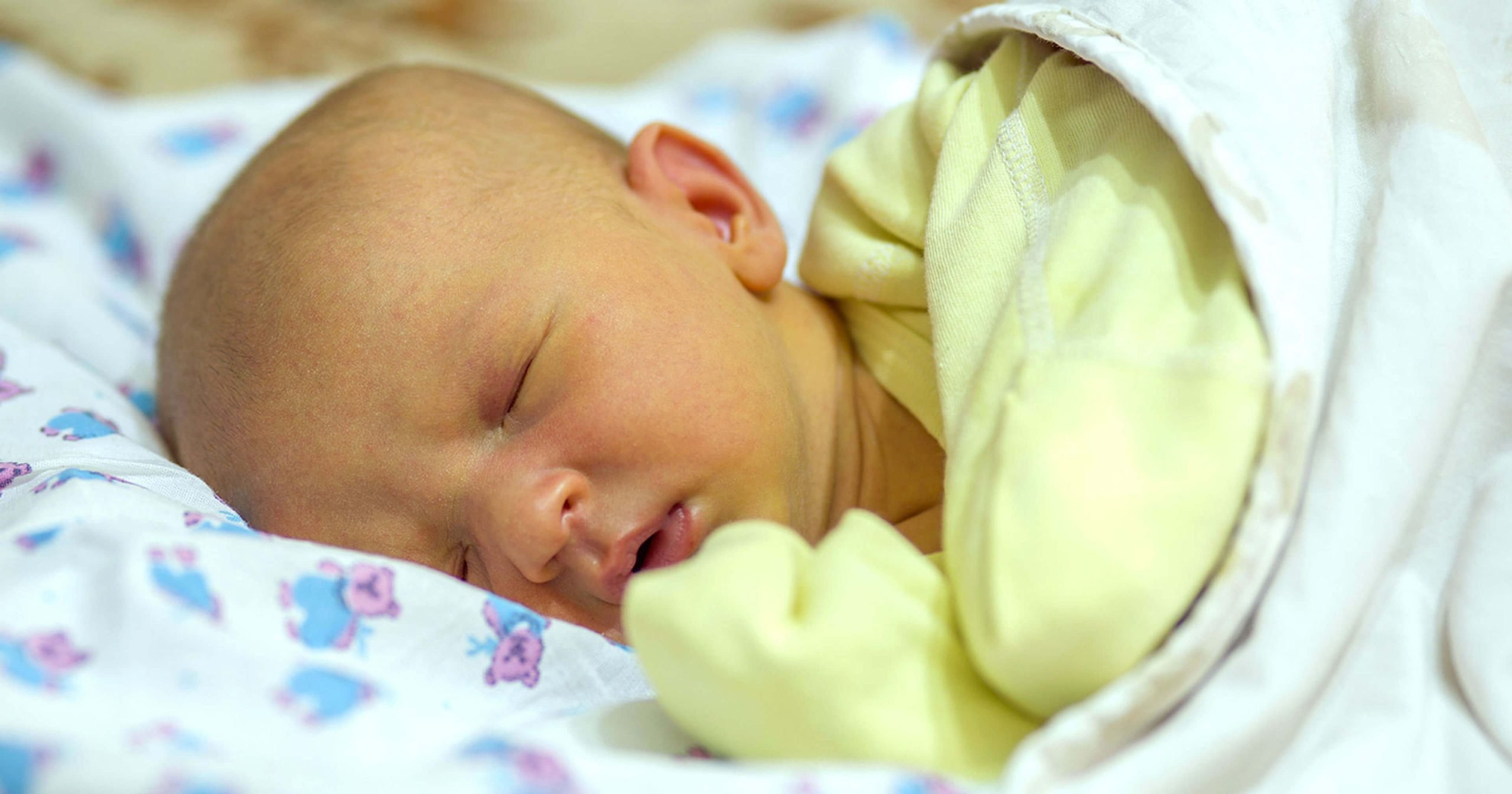 Things to Know About Untreated Jaundice in Newborns  BABY ...