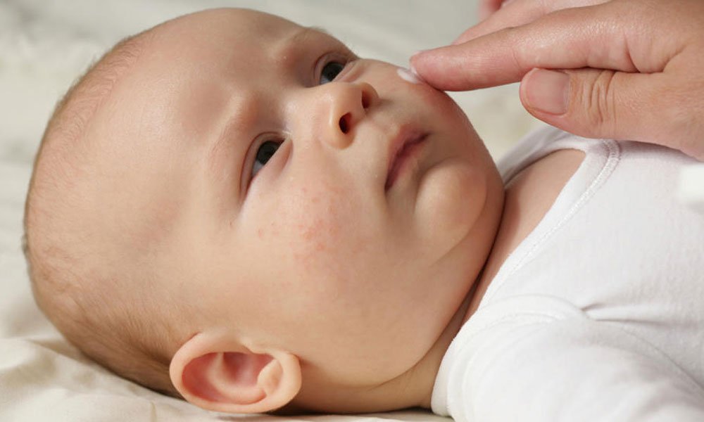 Top 10 Dry Skin Care Tips For Babies